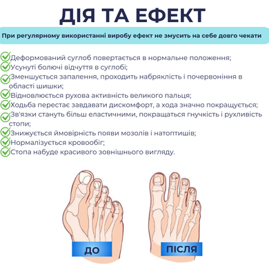 Тренажер выпрямитель Supretto для больших пальцев ног при вальгусе (8939)